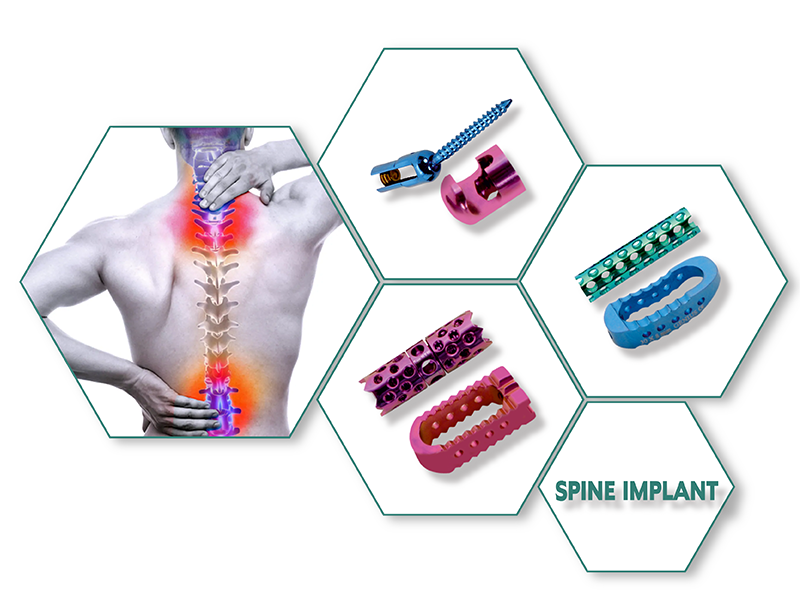 SPINE